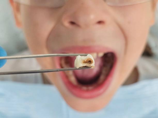 Best Emergency Gum Treatment in Heyville, AL