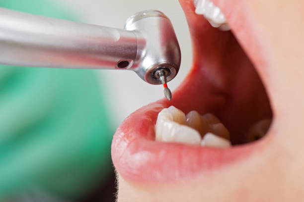 Best Same-Day Emergency Dental Services in Heyville, AL